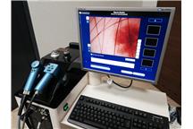 Videodermatoskop Derma Medical Molemax 3 (4).jpg