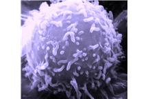 Wszystkie nowotwory są podatne na indukowaną śmierć komórkową
