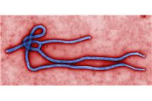 Na razie wiadomo, że za zachorowania nie jest odpowiedzialny wirus ebola Na razie wiadomo, że za zachorowania nie jest odpowiedzialny wirus ebola