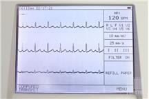 Aparat EKG SCHILLER CARDIOVIT AT-102 
