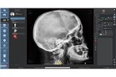 DigipaX – Oprogramowanie RTG dla Radiologii