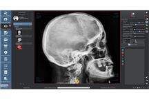 DigipaX – Oprogramowanie RTG dla Radiologii