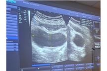 Szkolenie z uroginekologii więcej na www.PROskan.pl i www.MedPower.pl