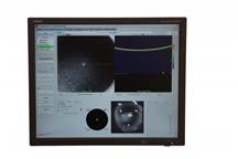 Tomograf okulistyczny - oftalmoskop laserowy