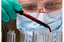 Nowy lek jest nadzieją dla pacjentów, którzy nie tolerują chemioterapii Nowy lek jest nadzieją dla pacjentów, którzy nie tolerują chemioterapii