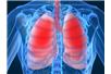 Na zwłóknienie płuc choruje na świecie około 5 mln osób