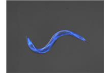 Na zdjęciu Caenorhabditis elegans Na zdjęciu Caenorhabditis elegans