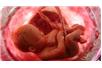 DNA płodu pobierane jest z krwi matki