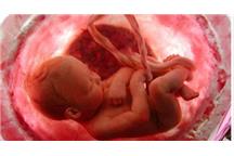 DNA płodu pobierane jest z krwi matki DNA płodu pobierane jest z krwi matki
