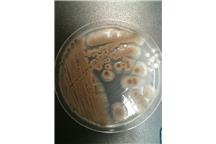 Na zdjęciu grzyb Aspergillus versicolor Na zdjęciu grzyb Aspergillus versicolor