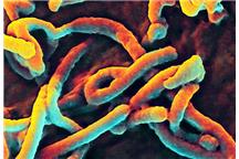 Na zdjęciu wirus Ebola w trakcie pączkowania Na zdjęciu wirus Ebola w trakcie pączkowania