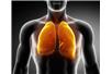 Chorujący na idiopatyczne zwłóknienie płuc zwykle palą papierosy