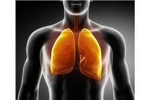 Chorujący na idiopatyczne zwłóknienie płuc zwykle palą papierosy